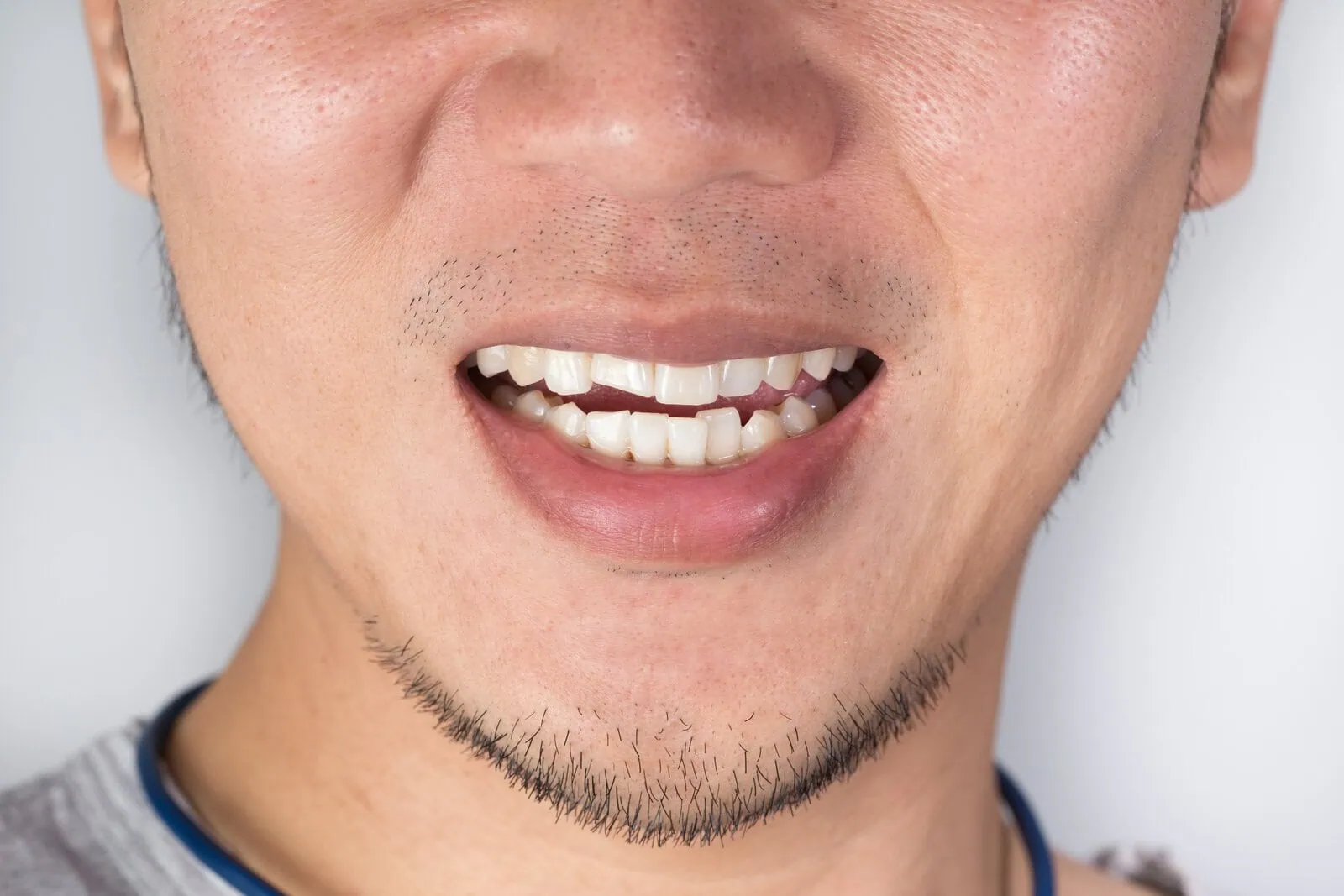 Time-sensitive dental injury requiring same-day care
