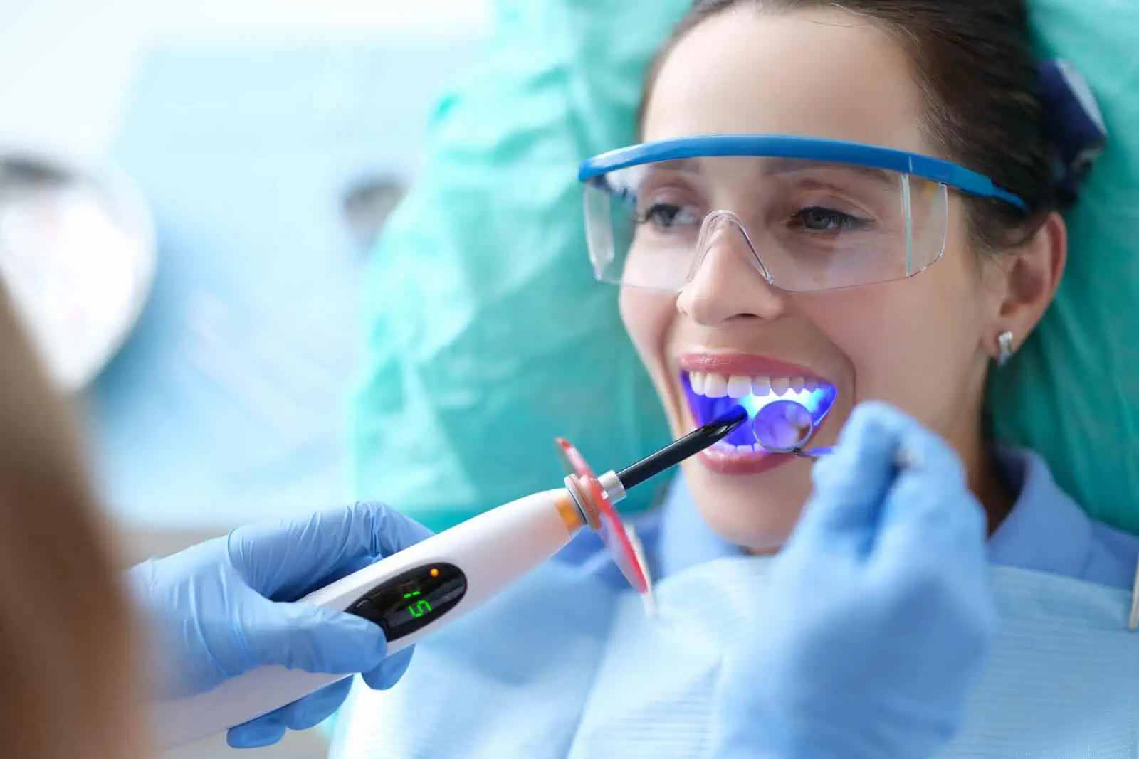 Composite dental bonding restoration